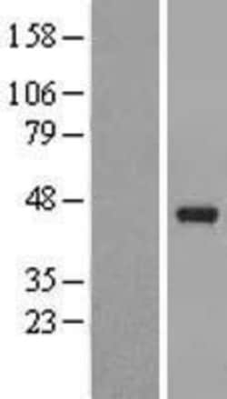 Novus Biologicals&trade;&nbsp;PAFAH2 Overexpression Lysate