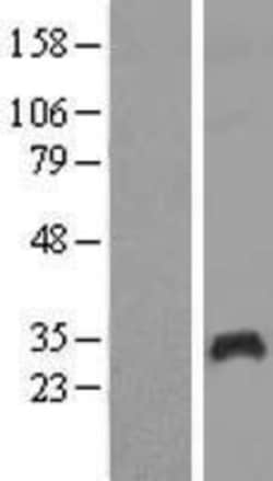Novus Biologicals&trade;&nbsp;PAGE1 Overexpression Lysate