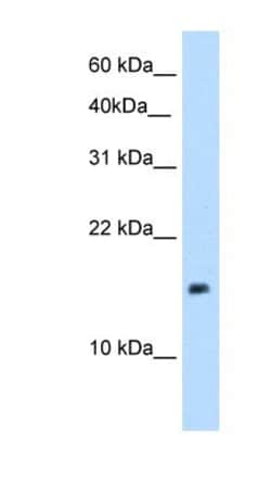 PAGE1 Antibody, Novus Biologicals 100&mu;L; Unlabeled:Antibodies, Polyclonal