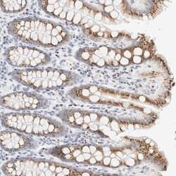 PAGE4 Antibody, Novus Biologicals 25 &mu;L; Unlabeled:Antibodies, Polyclonal