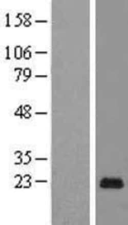 Novus Biologicals&trade;&nbsp;PAGE5 Overexpression Lysate