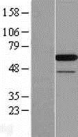 Novus Biologicals™ PAIP1 Overexpression Lysate