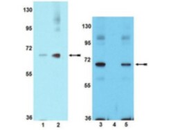 PAK1, p Ser204 Antibody, Novus Biologicals 0.1 mL; Unconjugated:Antibodies,