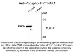 PAK1, p Thr84 Antibody, Novus Biologicals 0.1mL; Unlabeled:Antibodies,