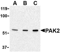 PAK2 Antibody - BSA Free, Novus Biologicals 0.025 mg, Unconjugated:Antibodies,