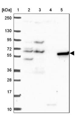 PAK3 Antibody, Novus Biologicals 25 &mu;L, Unlabeled:Antibodies, Polyclonal