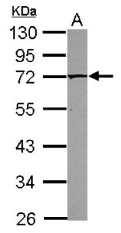PAK4 Antibody, Novus Biologicals 0.1mL; Unlabeled:Antibodies, Polyclonal