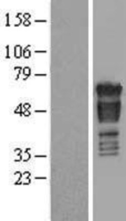 Novus Biologicals™ PAK4 Overexpression Lysate
