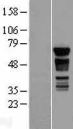 Novus Biologicals™ PAK4 Overexpression Lysate