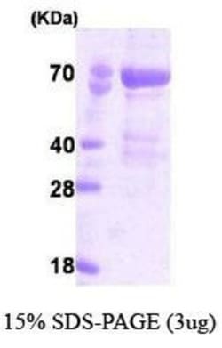 Novus Biologicals&trade;&nbsp;Recombinant Human PAK4 His Protein