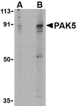 PAK7 Antibody - BSA Free, Novus Biologicals 0.1mg; Unlabeled:Antibodies,