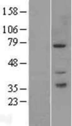 Novus Biologicals&trade;&nbsp;PAK6 Overexpression Lysate