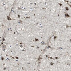 Paladin Antibody, Novus Biologicals 0.1mL; Unlabeled:Antibodies, Polyclonal