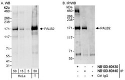 PALB2 Antibody, Novus Biologicals 100 &mu;L | Buy Online | Novus Biologicals | Fisher Scientific