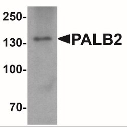 PALB2 Antibody - BSA Free, Novus Biologicals 0.025 mg, Unconjugated:Antibodies,