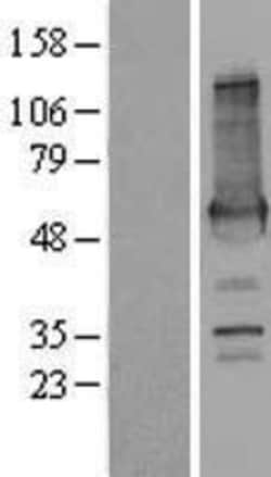 Novus Biologicals&trade;&nbsp;AKAP2 Overexpression Lysate