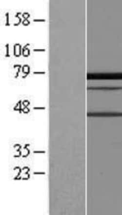 Novus Biologicals&trade;&nbsp;PALMD Overexpression Lysate
