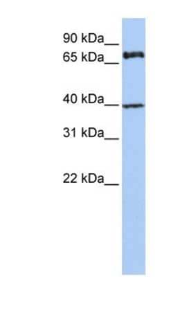 PALS1/MPP5 Antibody, Novus Biologicals 100&mu;L; Unlabeled:Antibodies,