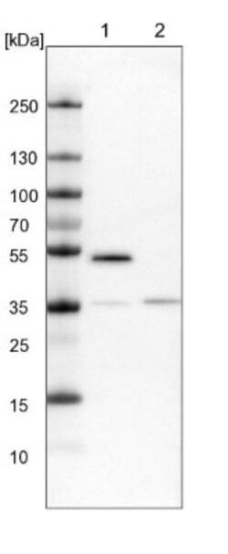 PAMCI Antibody, Novus Biologicals:Antibodies:Primary Antibodies