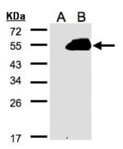 PAMCI Antibody, Novus Biologicals 0.1mL; Unlabeled:Antibodies, Polyclonal