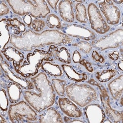 PAMCI Antibody, Novus Biologicals:Antibodies:Primary Antibodies