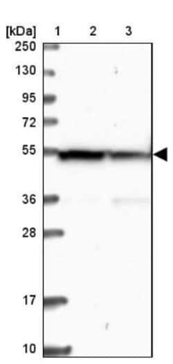 PAMCI Antibody, Novus Biologicals:Antibodies:Primary Antibodies