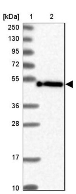PAMCI Antibody, Novus Biologicals 0.1mL; Unlabeled:Antibodies, Polyclonal