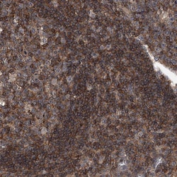 PAN3 Antibody, Novus Biologicals 25 &mu;L; Unlabeled:Antibodies, Polyclonal