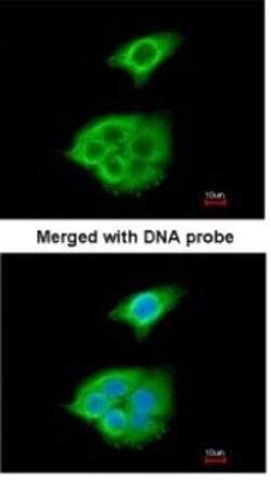 Pancreatic Lipase Antibody, Novus Biologicals 100 &mu;L | Buy Online | Novus Biologicals | Fisher Scientific