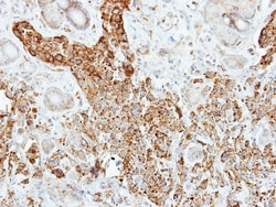 Pancreatic Lipase Antibody, Novus Biologicals 100 &mu;L | Buy Online | Novus Biologicals | Fisher Scientific