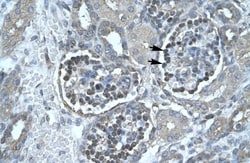 Pancreatic Lipase Antibody, Novus Biologicals 100&mu;L; Unlabeled:Antibodies,