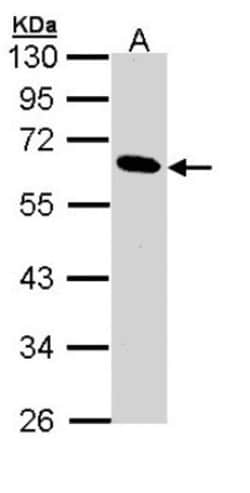 Pancreatic Lipase Antibody, Novus Biologicals 100 &mu;L | Buy Online | Novus Biologicals | Fisher Scientific