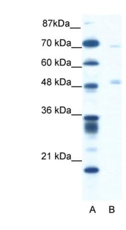 Pancreatic Lipase Antibody, Novus Biologicals 0.1mg; Unlabeled:Antibodies,