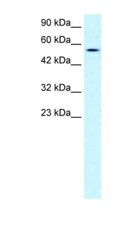 Pancreatic Lipase Antibody, Novus Biologicals 100&mu;L; Unlabeled:Antibodies,