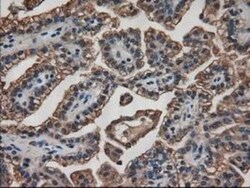 Pancreatic Amylase Alpha Antibody (OTI6D4), Novus Biologicals 0.1mL; Unlabeled:Antibodies,