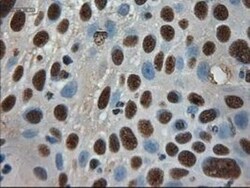 Pancreatic Amylase Alpha Antibody (OTI6D4), Novus Biologicals 0.1mL; Unlabeled:Antibodies,