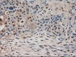 Pancreatic Amylase Alpha Antibody (OTI6D4), Novus Biologicals 0.1mL; Unlabeled:Antibodies,