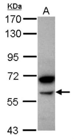 Pancreatic Amylase Beta Antibody, Novus Biologicals 0.1mL; Unlabeled:Antibodies,