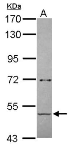 Pancreatic Amylase Beta Antibody, Novus Biologicals 0.1mL; Unlabeled:Antibodies,