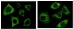 Cytokeratin, pan Antibody (7H8C4), Novus Biologicals 0.1mL; Unlabeled:Antibodies,