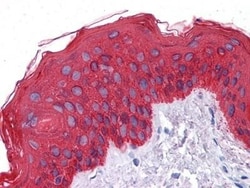 Cytokeratin, pan Antibody (7H8C4), Novus Biologicals 0.1mL; Unlabeled:Antibodies,