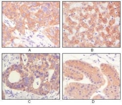 Cytokeratin, pan Antibody (7H8C4), Novus Biologicals 0.1mL; Unlabeled:Antibodies,