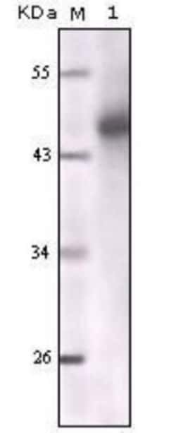 Cytokeratin, pan Antibody (7H8C4), Novus Biologicals 0.1mL; Unlabeled:Antibodies,