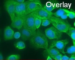 Cytokeratin, pan Antibody (PCK-26), Novus Biologicals 0.1mL; Unlabeled:Antibodies,