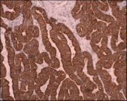 Cytokeratin, pan Antibody (PCK-26), Novus Biologicals 0.1mL; Unlabeled:Antibodies,