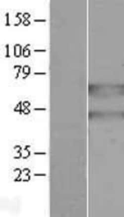 Novus Biologicals&trade;&nbsp;PANK2 Overexpression Lysate