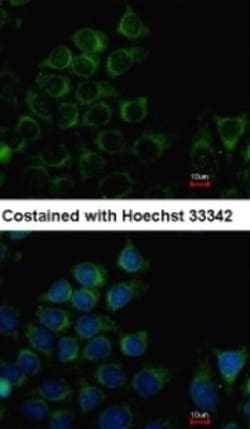PANK3 Antibody, Novus Biologicals 0.1mL; Unlabeled:Antibodies, Polyclonal