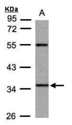 PANK3 Antibody, Novus Biologicals 0.1mL; Unlabeled:Antibodies, Polyclonal