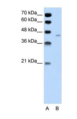 Pannexin-1 Antibody, Novus Biologicals 0.05mg; Unlabeled:Antibodies, Polyclonal