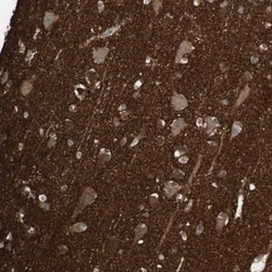 pan-Synuclein Antibody, Novus Biologicals:Antibodies:Primary Antibodies